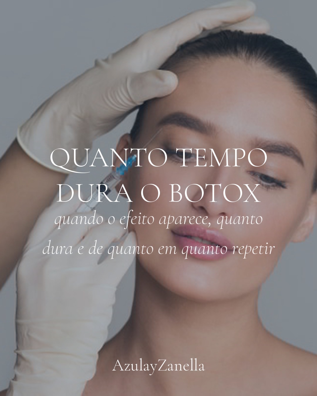 Quanto tempo dura o botox em Joinville, AzulayZanella