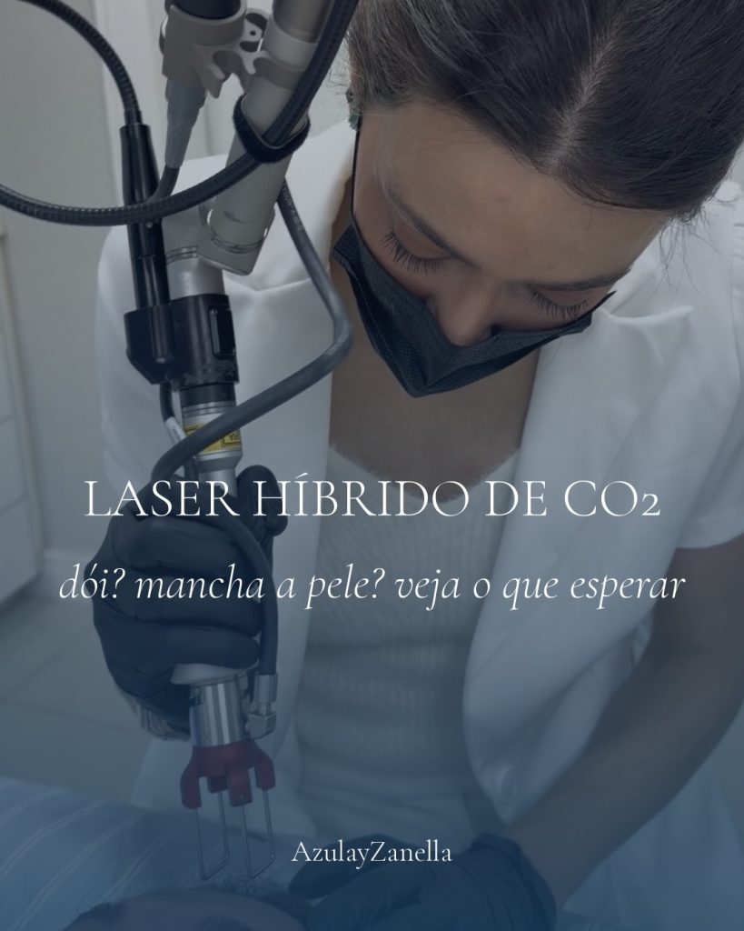 Capa do post Laser Híbrido de CO2: profissional aplicando laser na testa da paciente, com título e assinatura AzulayZanella sobre a foto