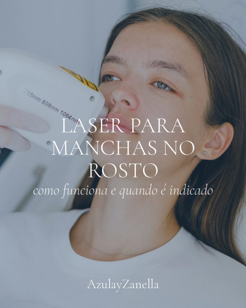 Capa do artigo sobre laser para manchas no rosto em Joinville