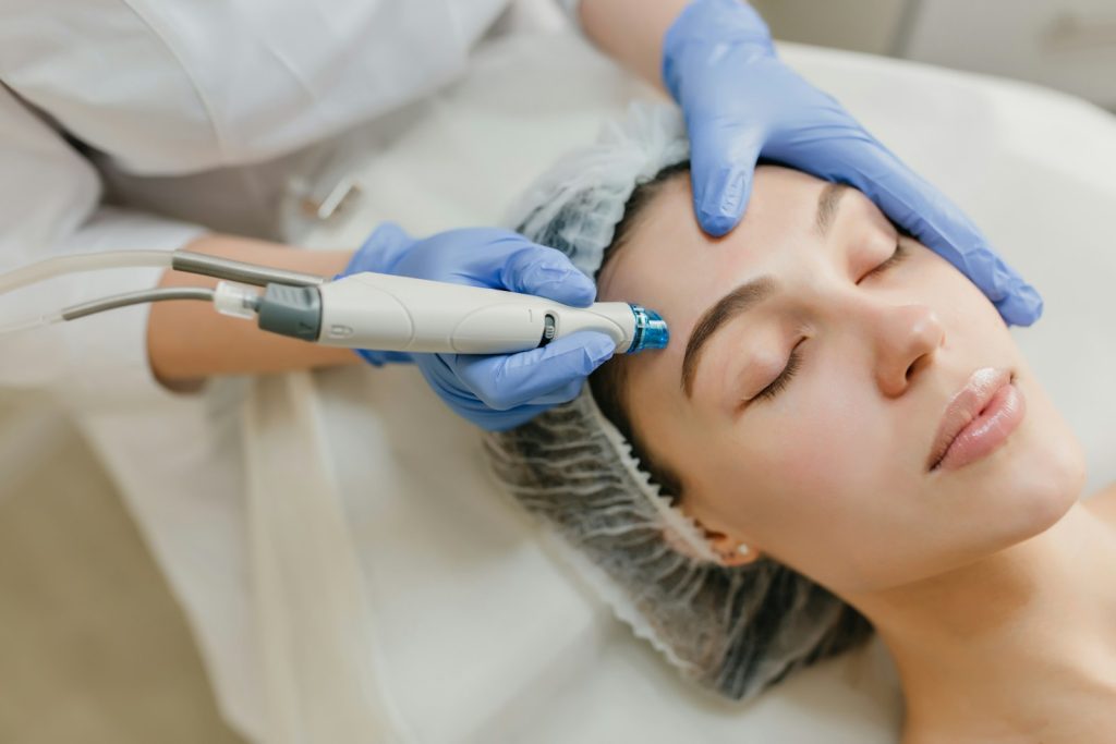 Procedimento de laser facial realizado por medico na AzulayZanella