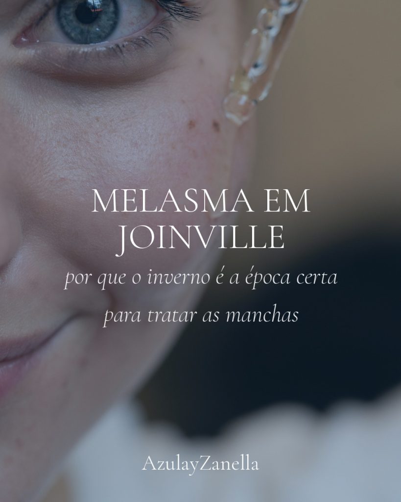 Capa do artigo sobre tratamento de melasma no inverno em Joinville