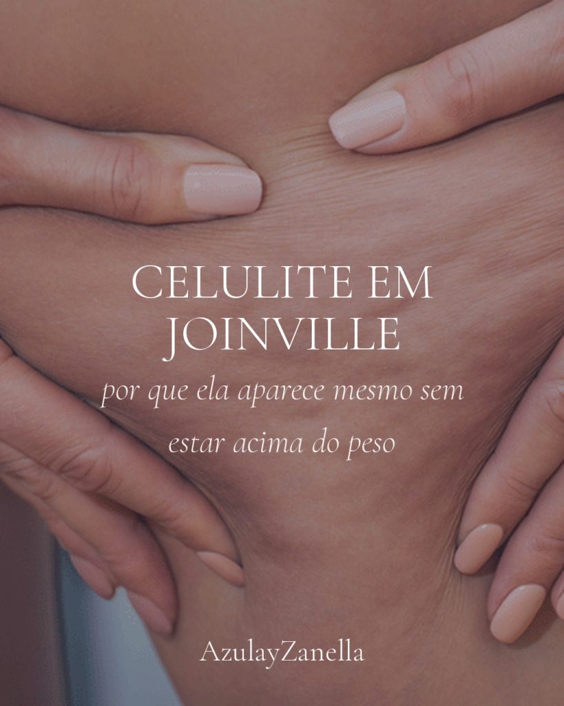 Celulite em Joinville, AzulayZanella